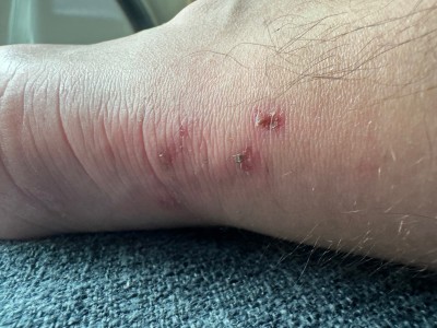 Imagen 2 de Jonathon  sobre Scarpa - Ribelle Run Kalibra G - Zapatillas de trail running